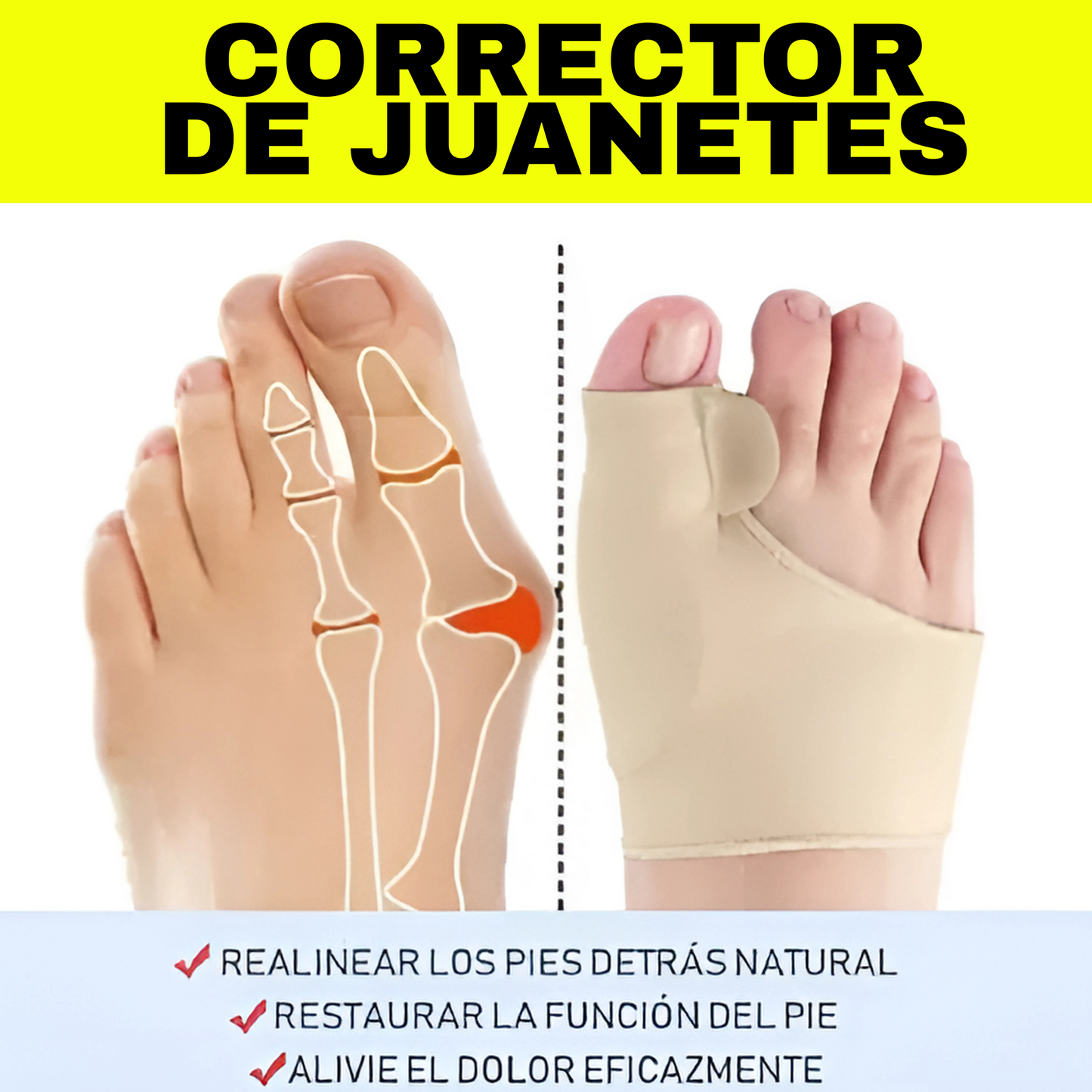 Corrector De Juanetes